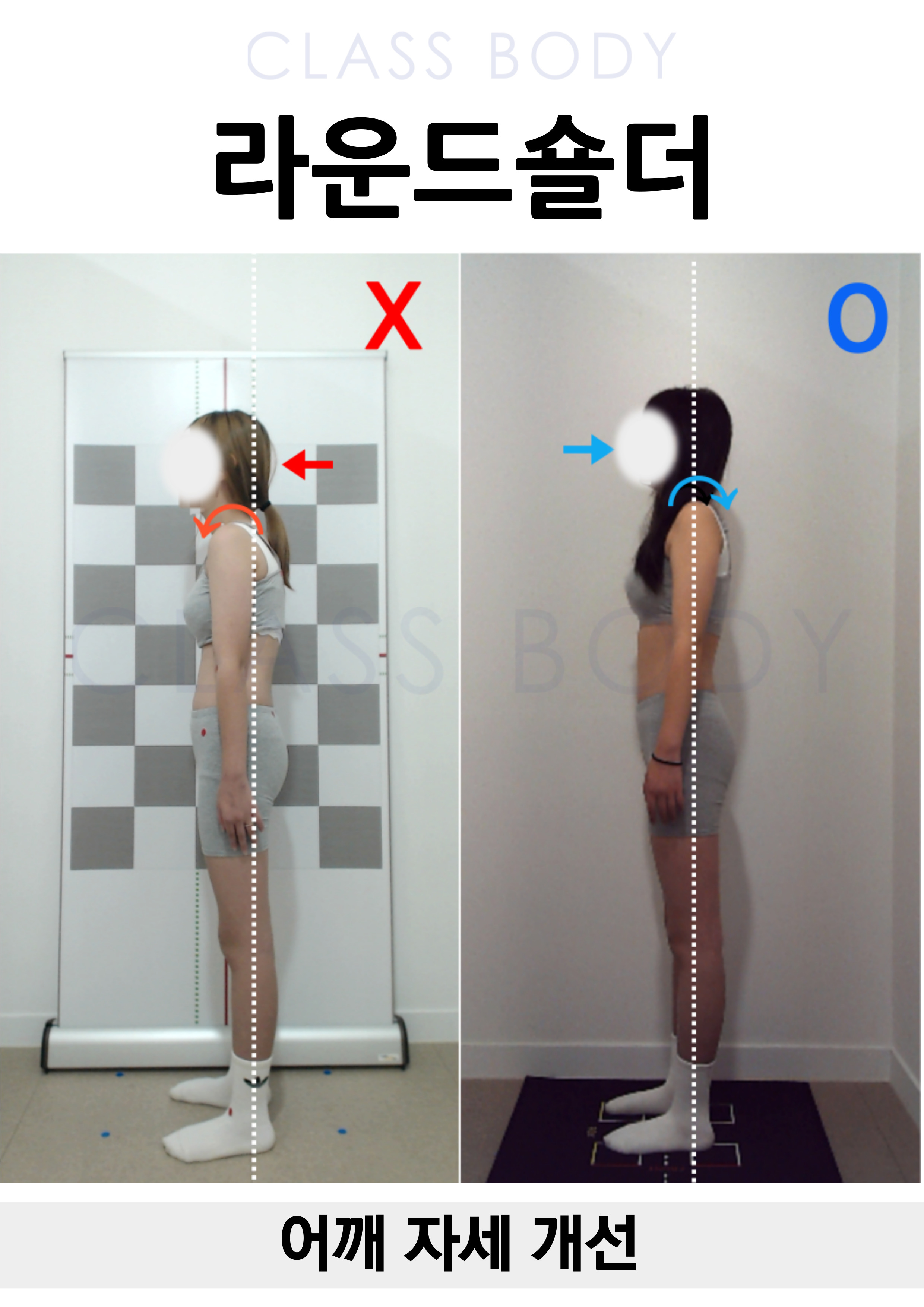라운드숄더 개선