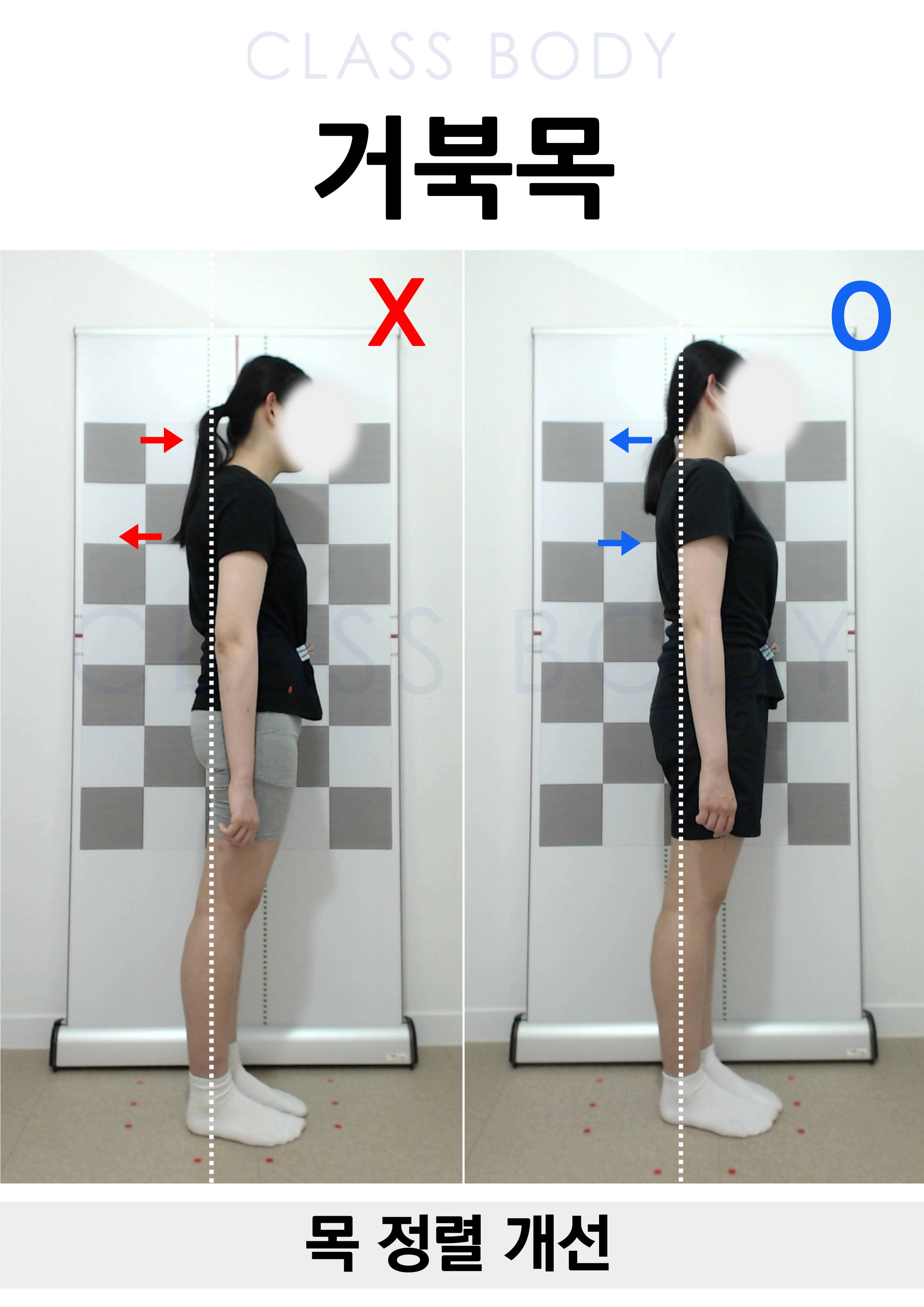 거북목개선