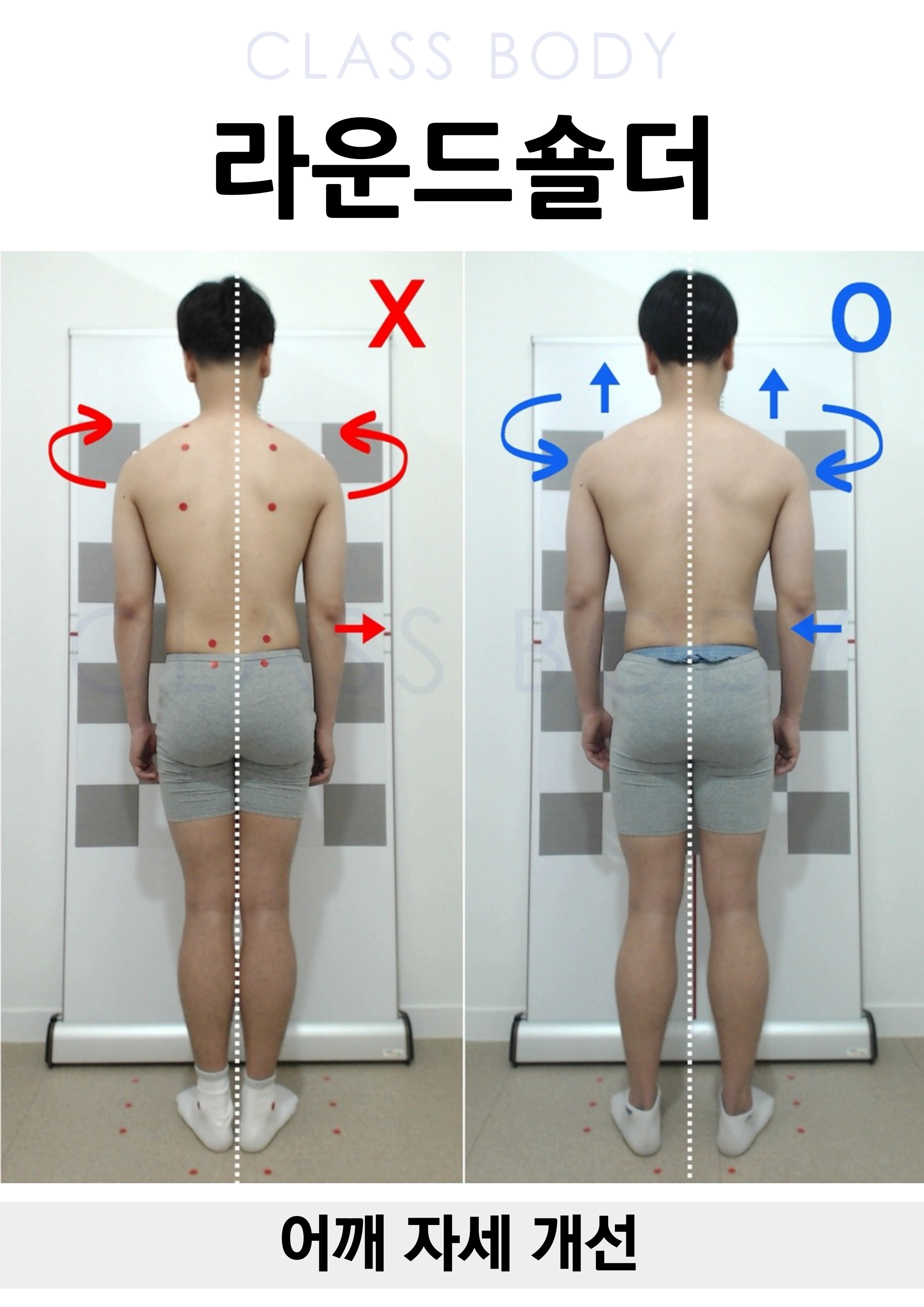 라운드숄더 개선