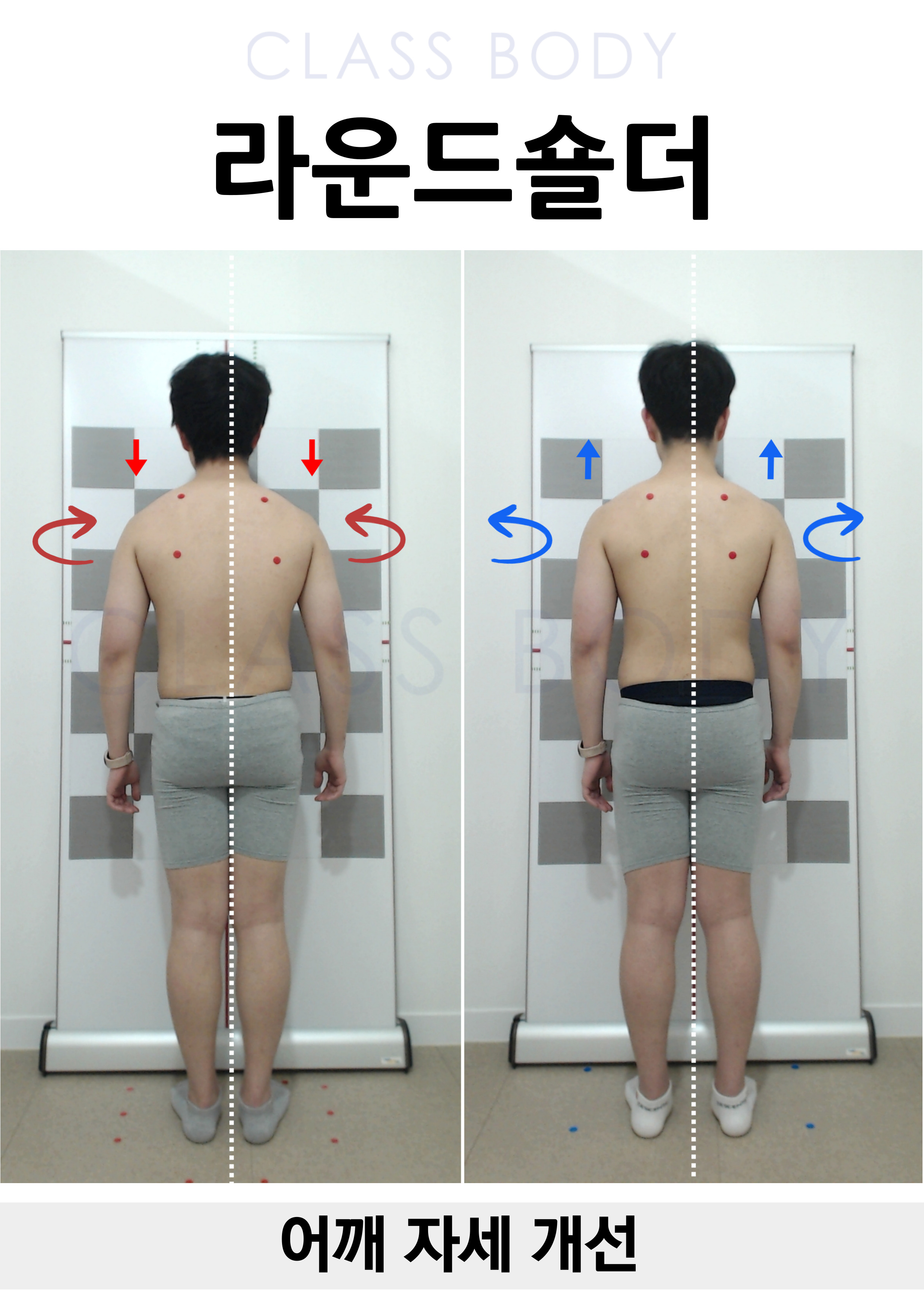라운드숄더 개선