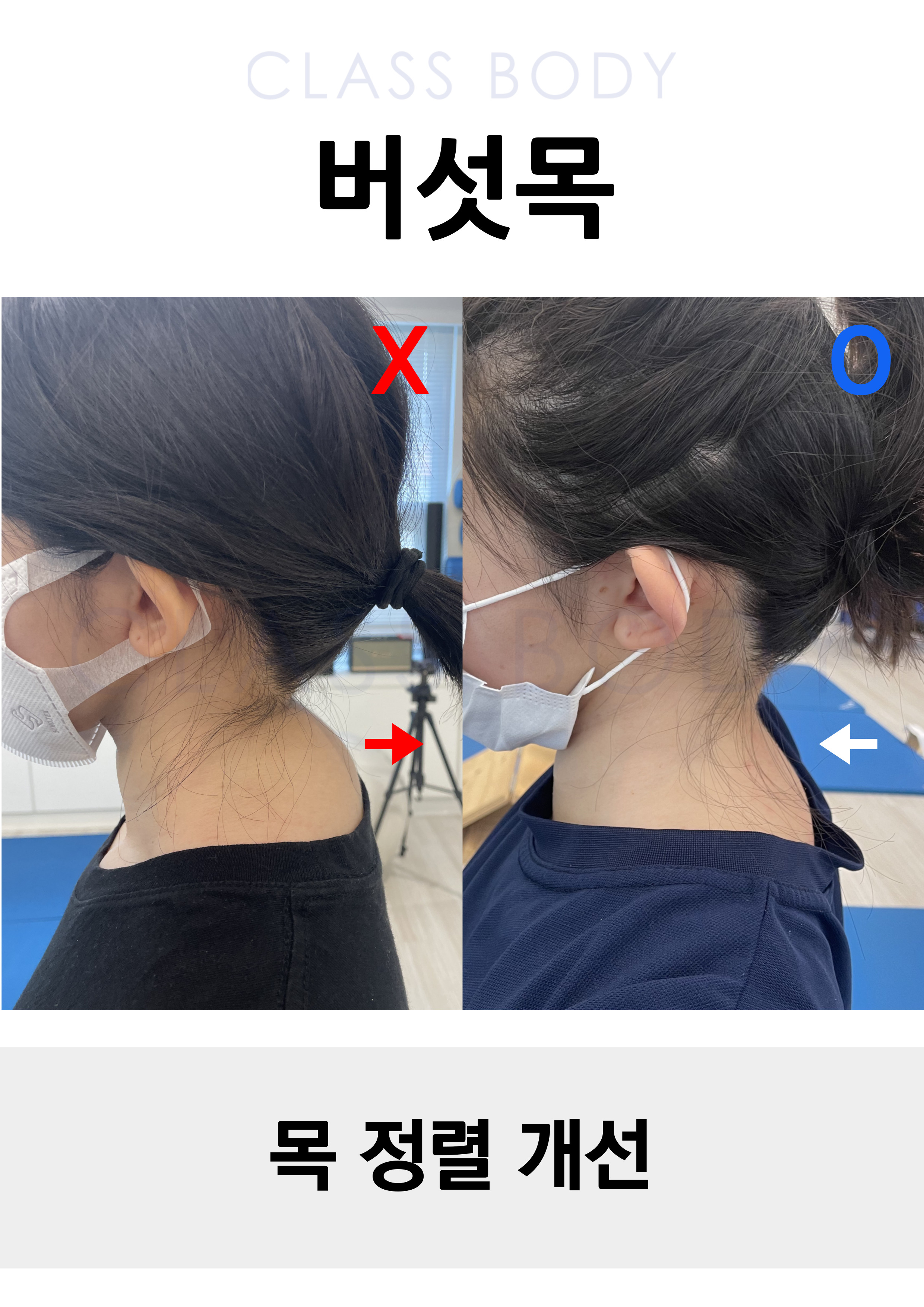 버섯목 개선