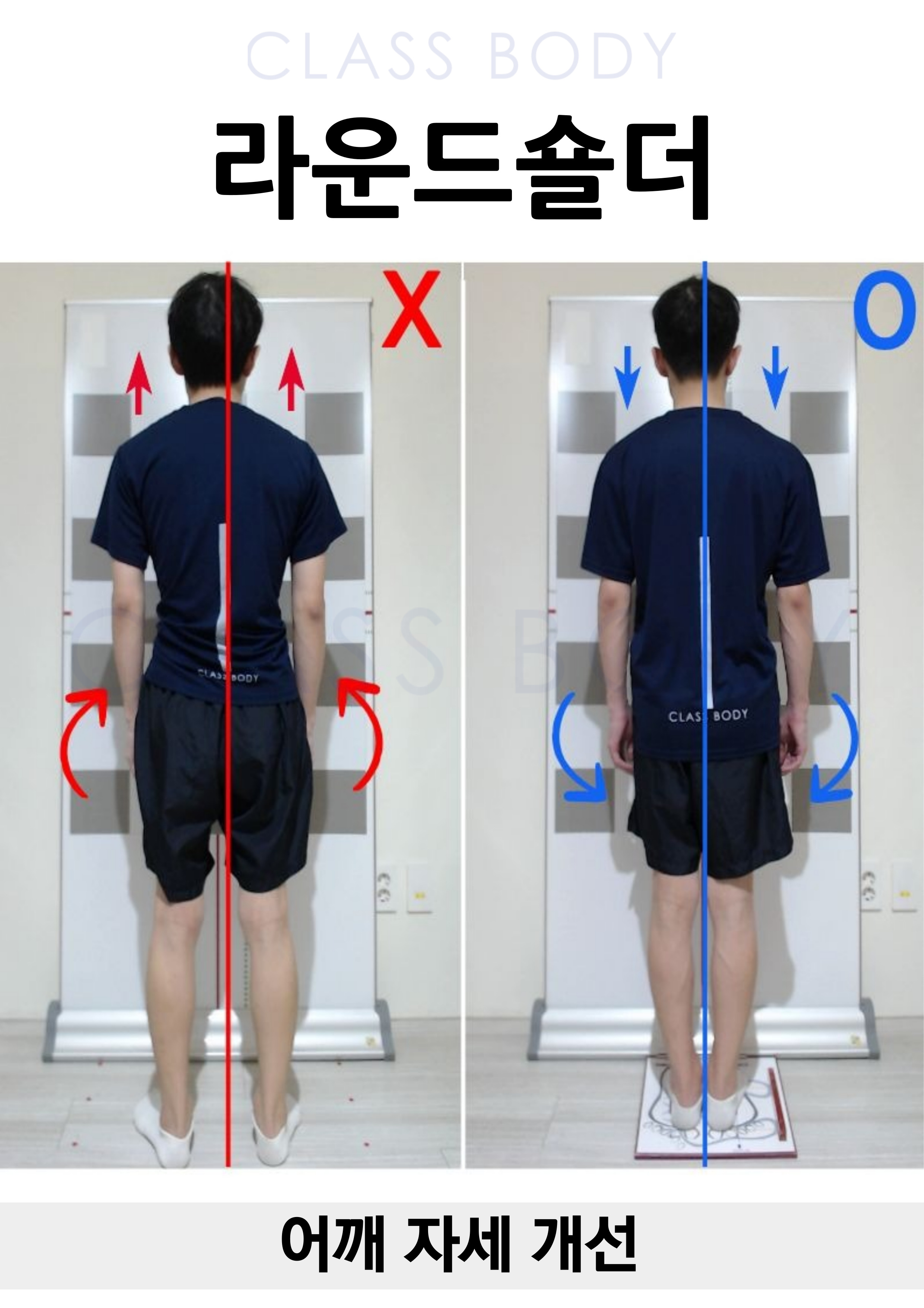 라운드숄더 개선