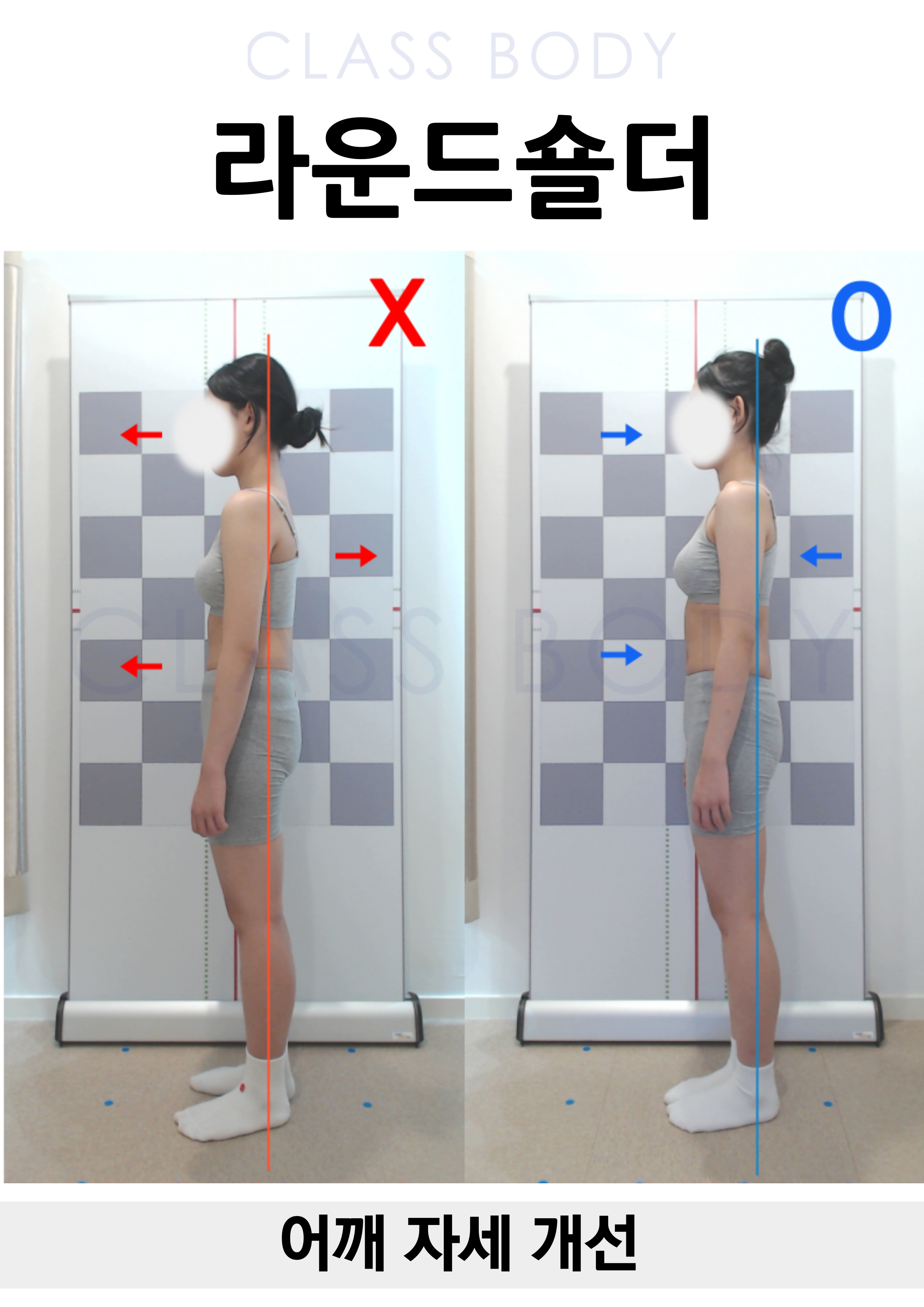 라운드숄더 개선