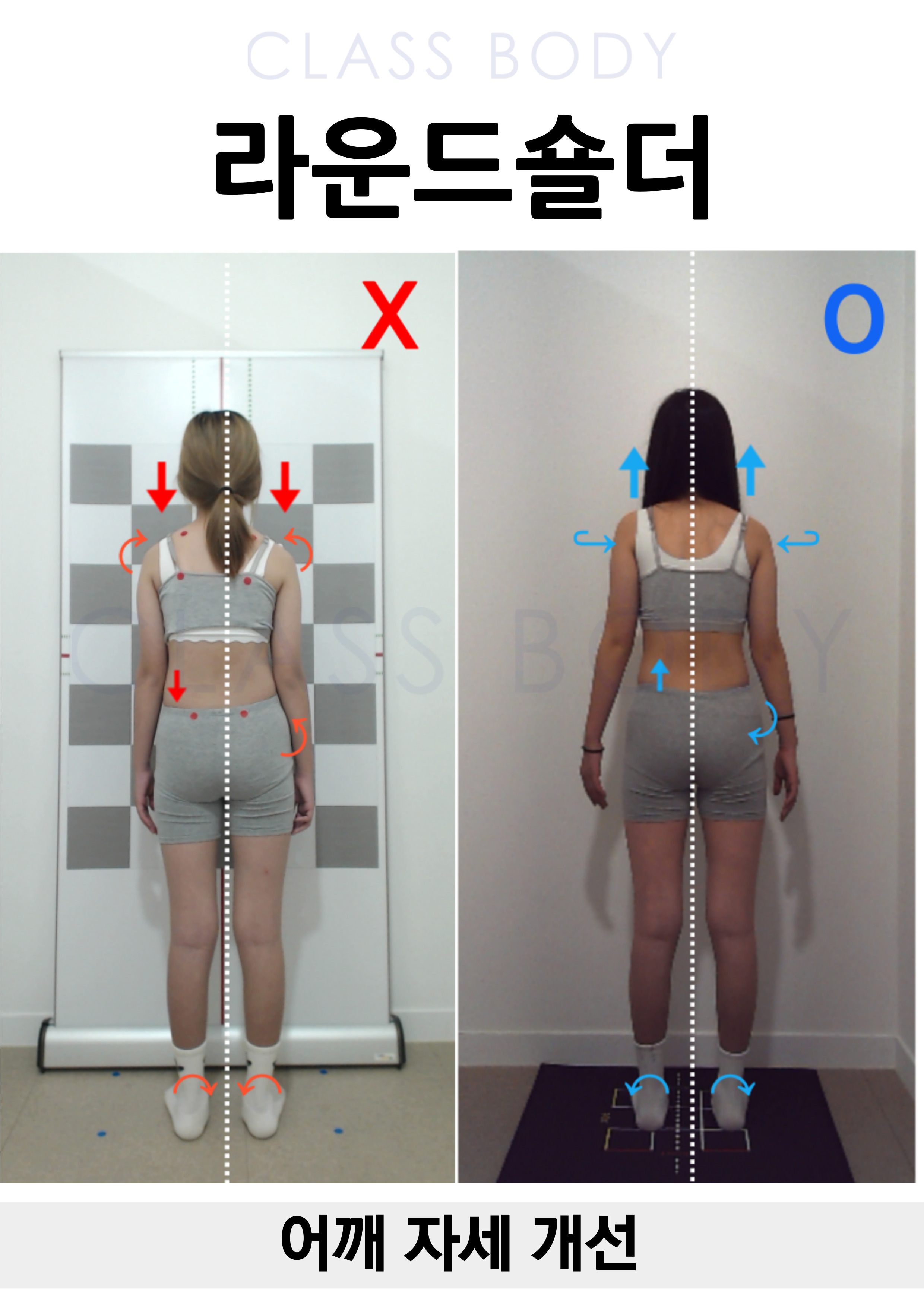 라운드숄더 개선