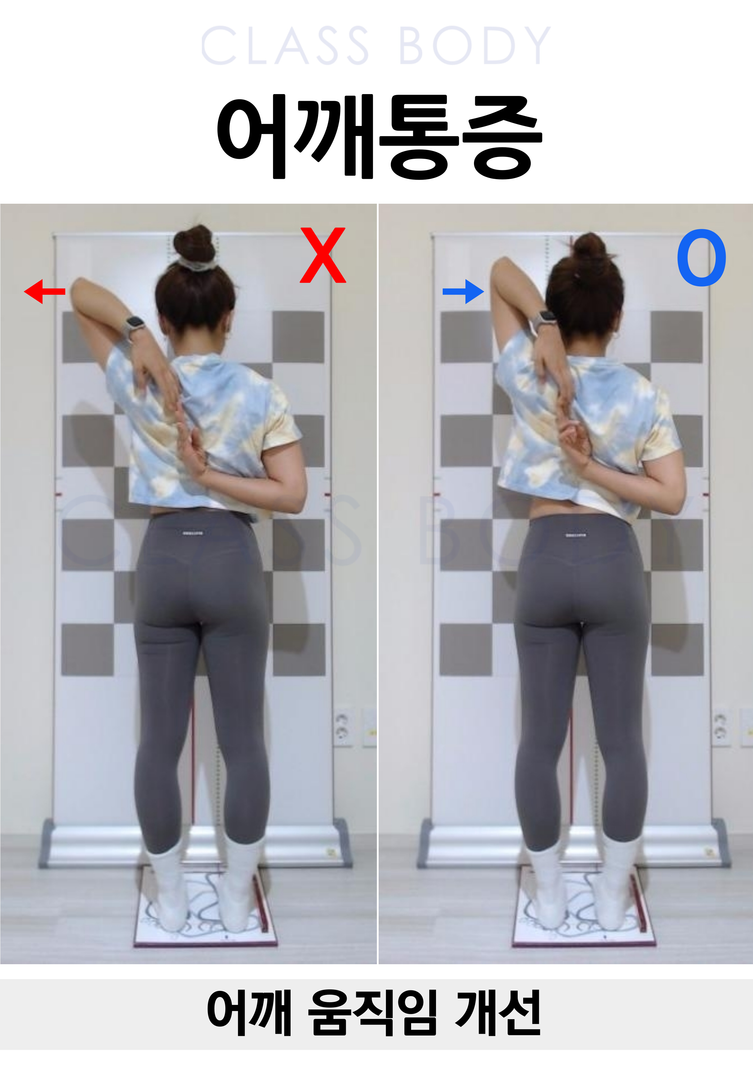 어깨통증 개선