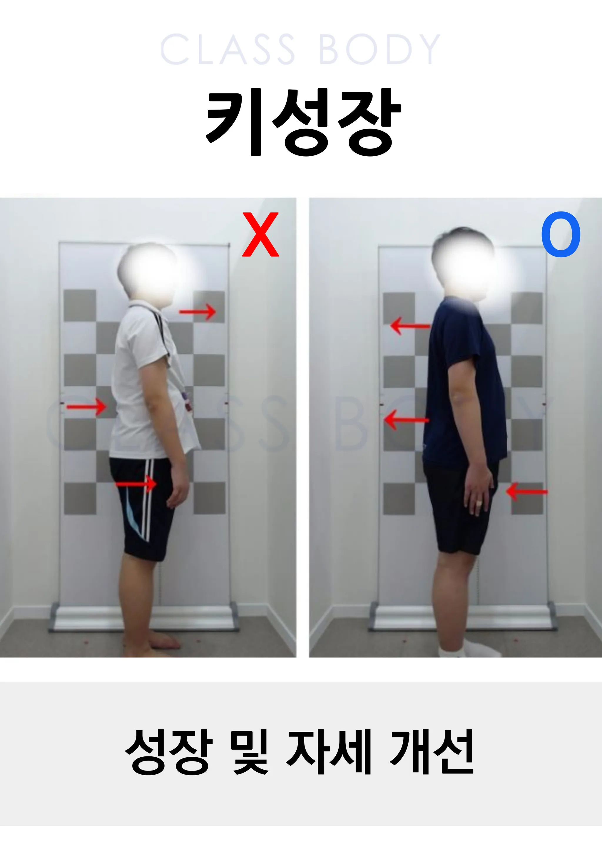 성장 및 자세 개선