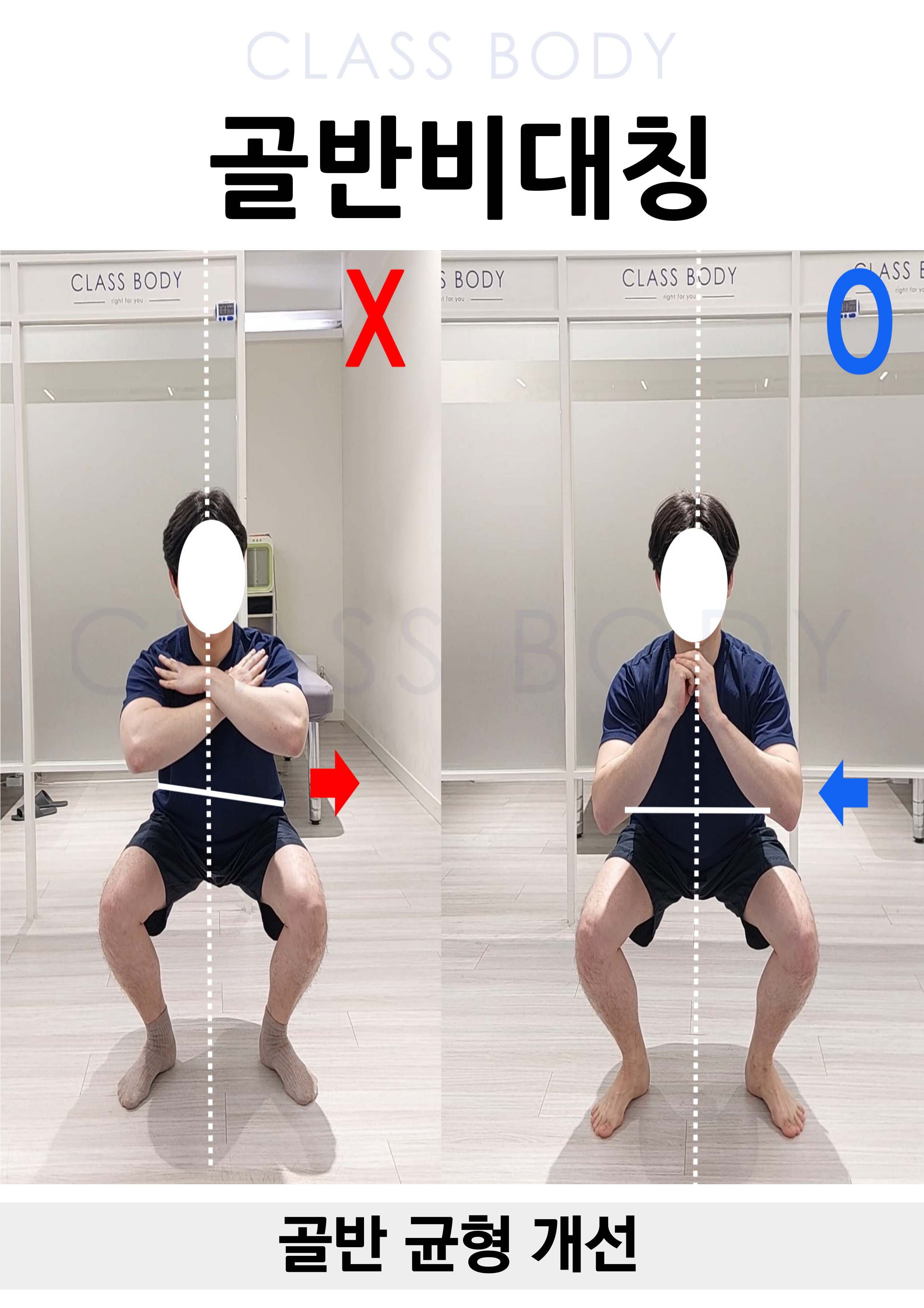 골반 균형 개선