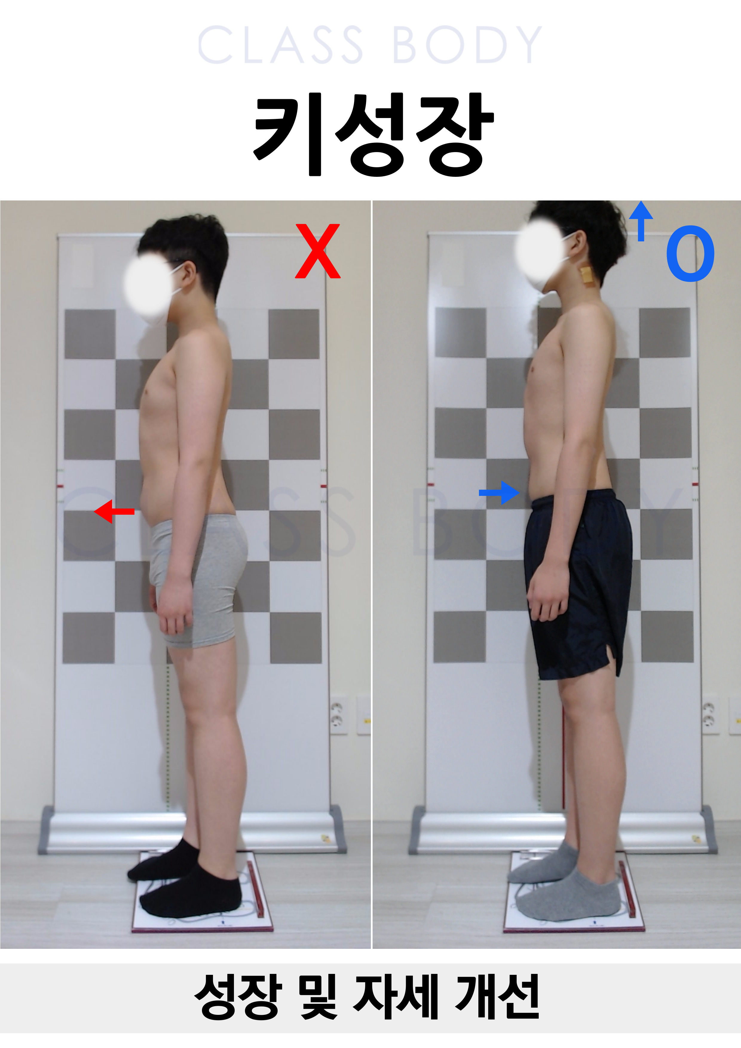 성장 및 자세 개선