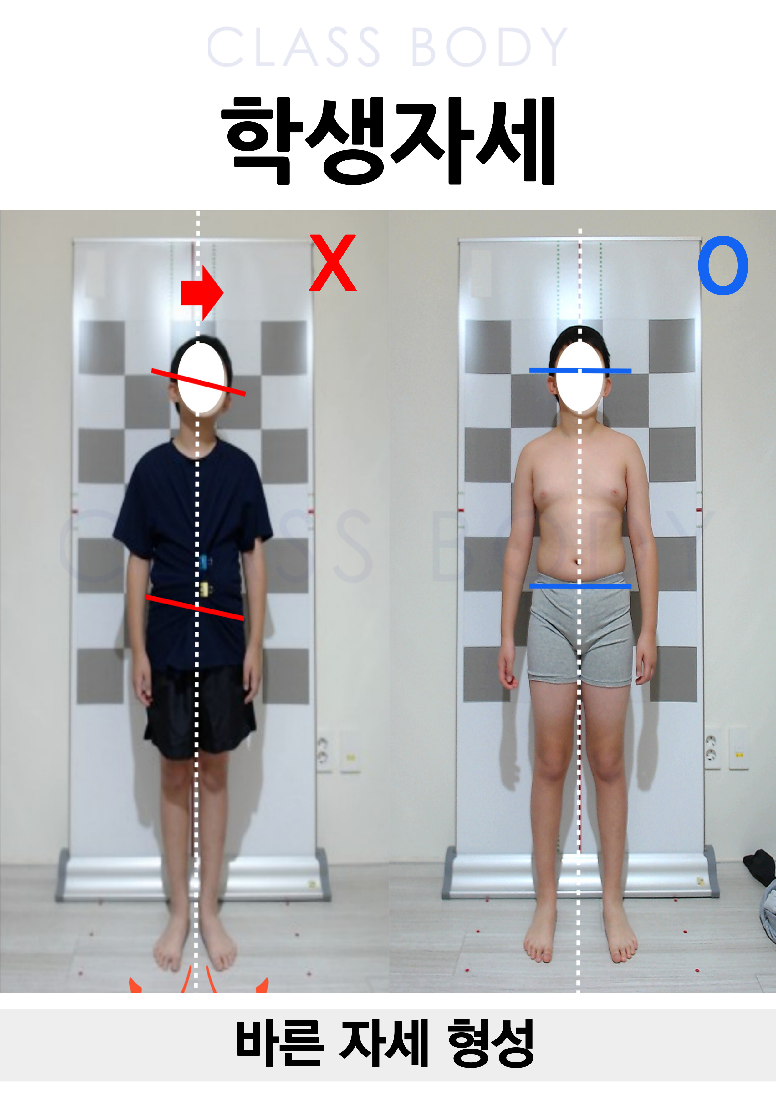 학생 자세 교정