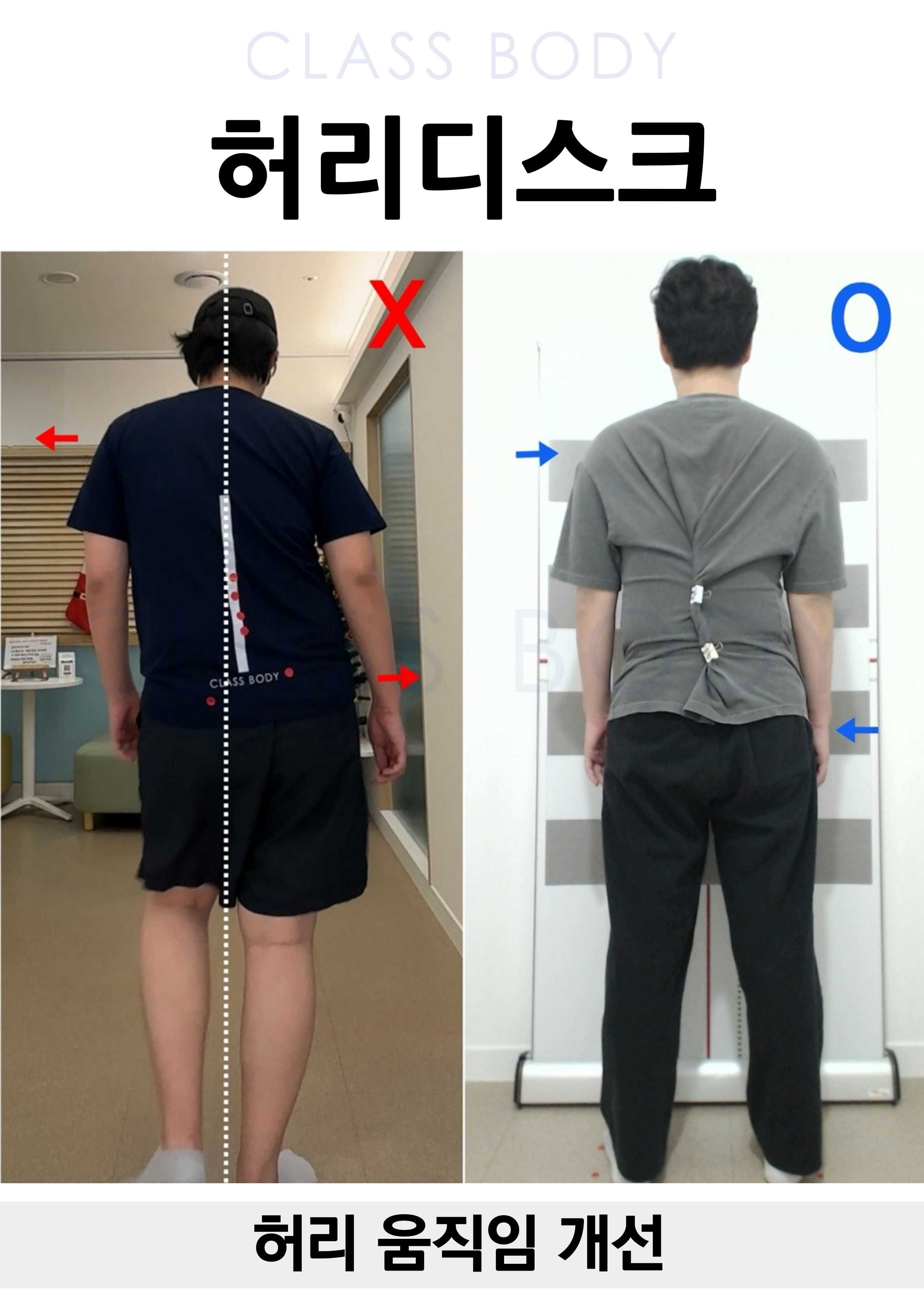 허리 움직임 개선