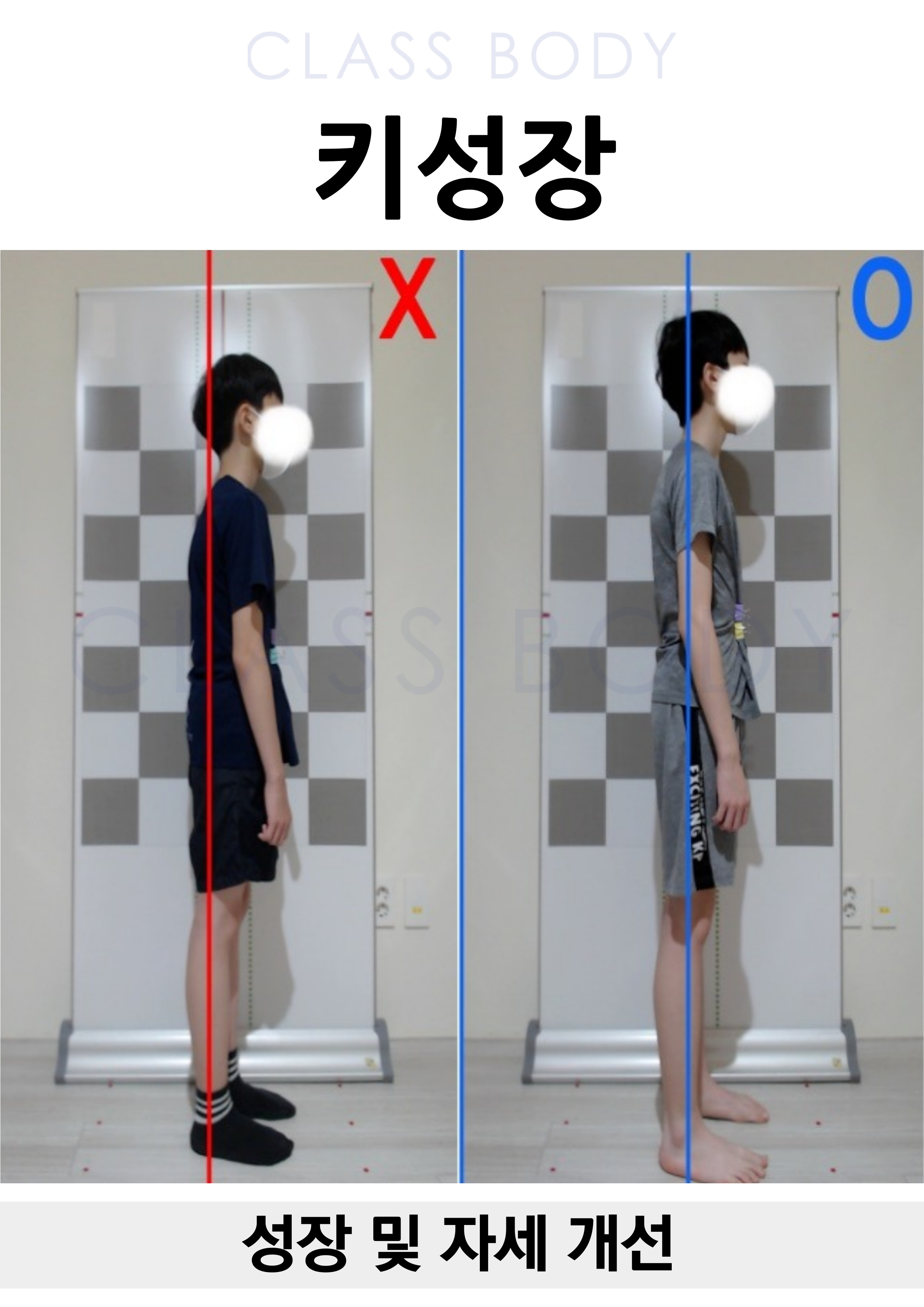 성장 및 자세 개선