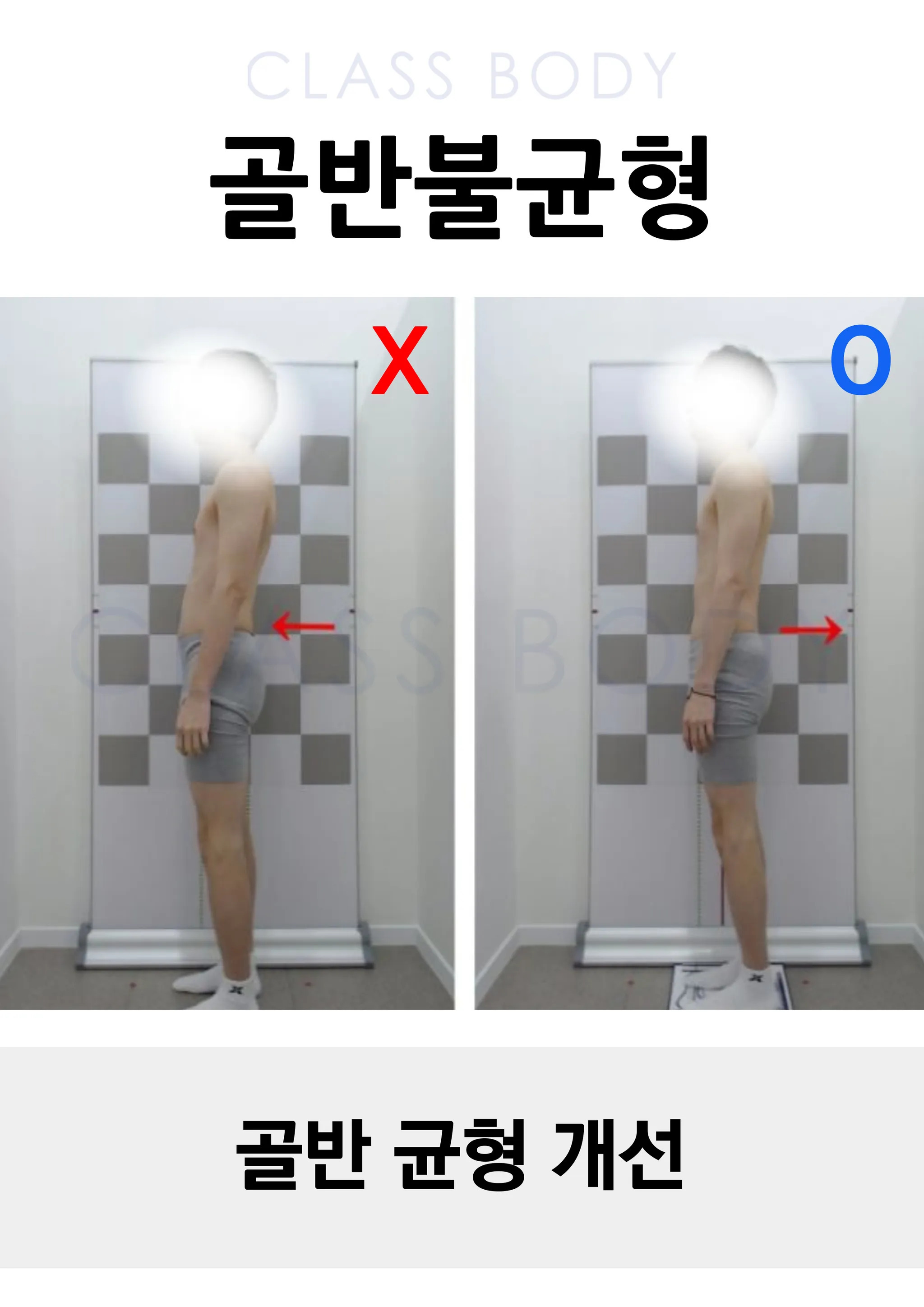 골반 균형 개선