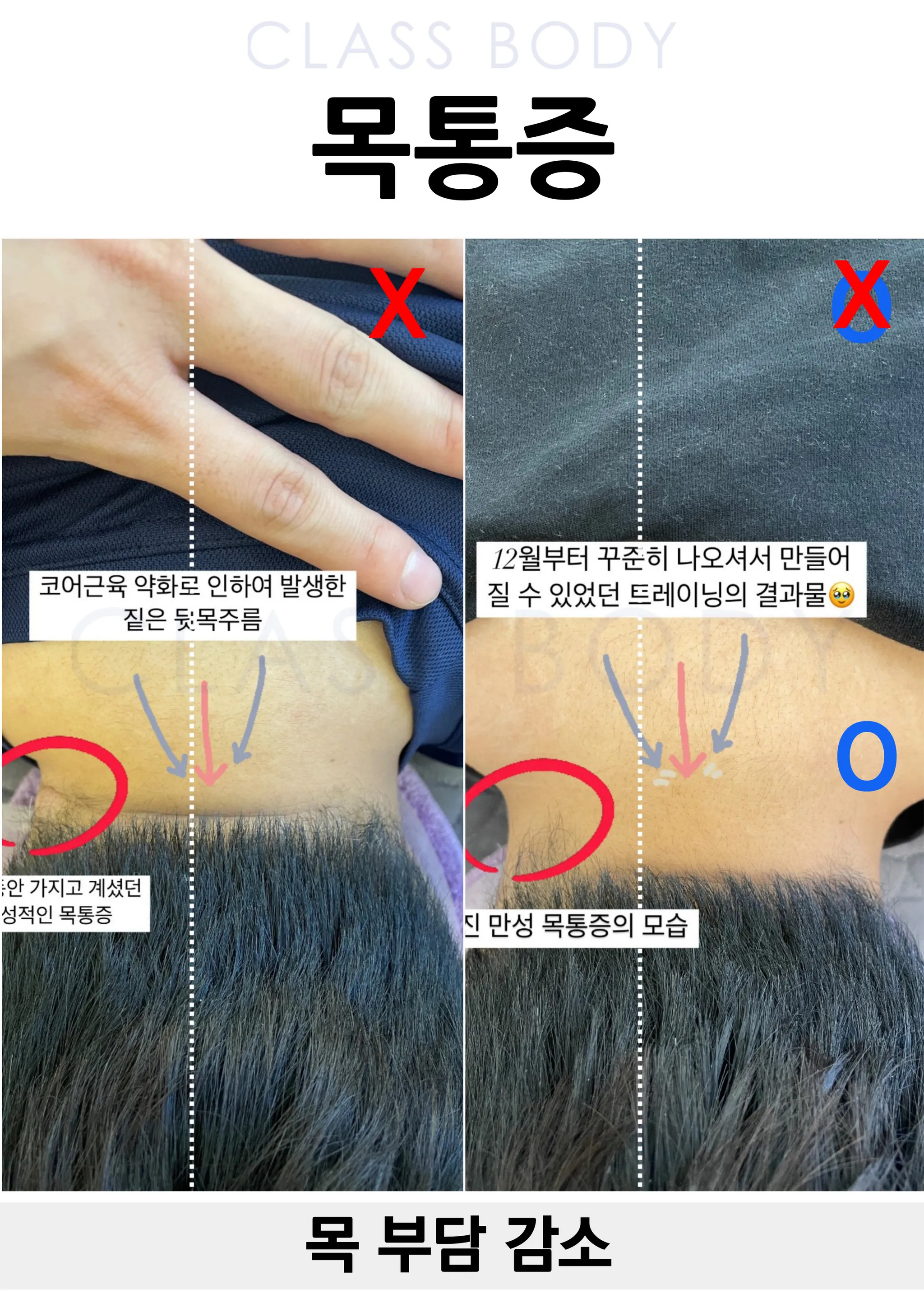 목 부담 감소