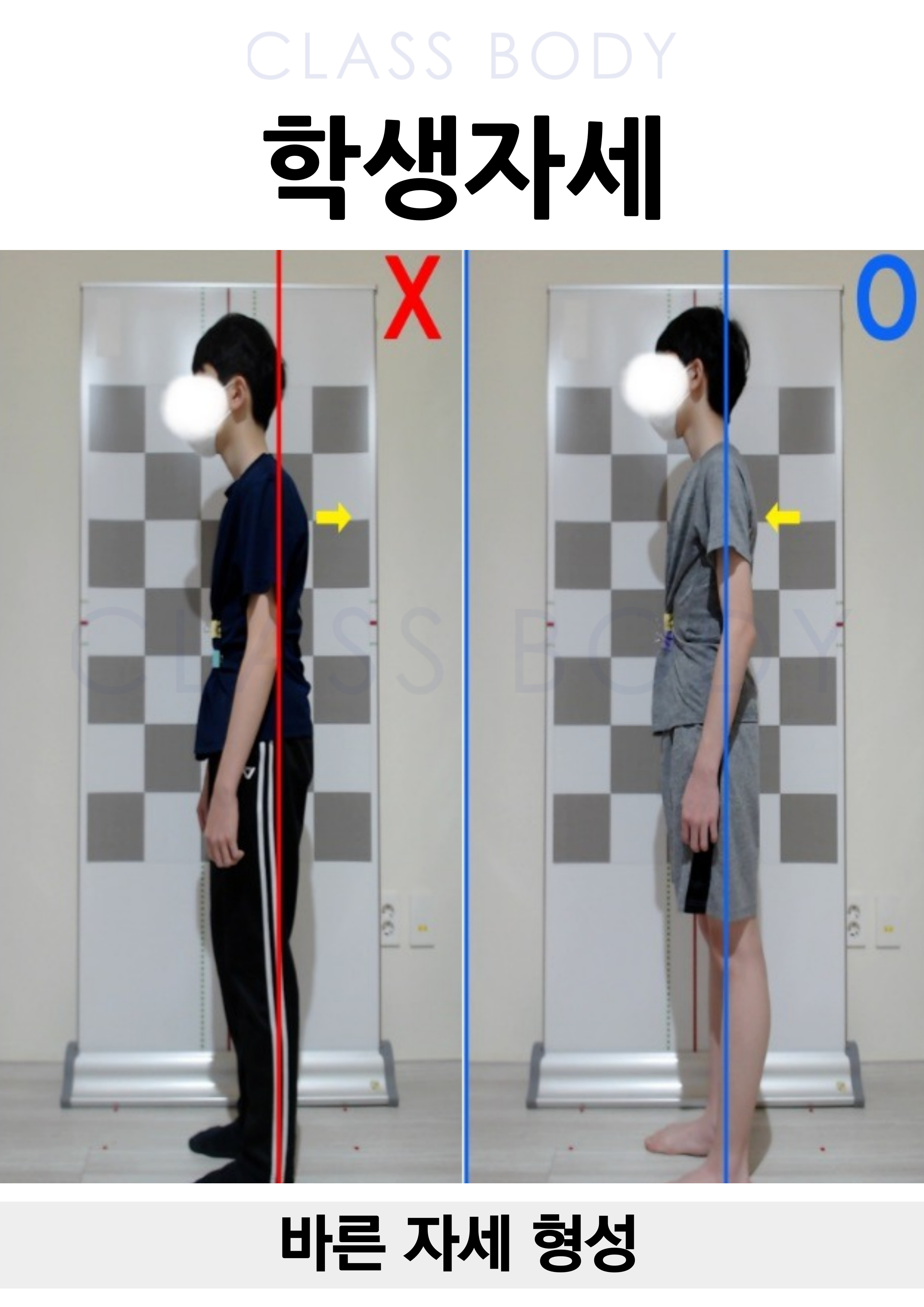 바른 자세 형성