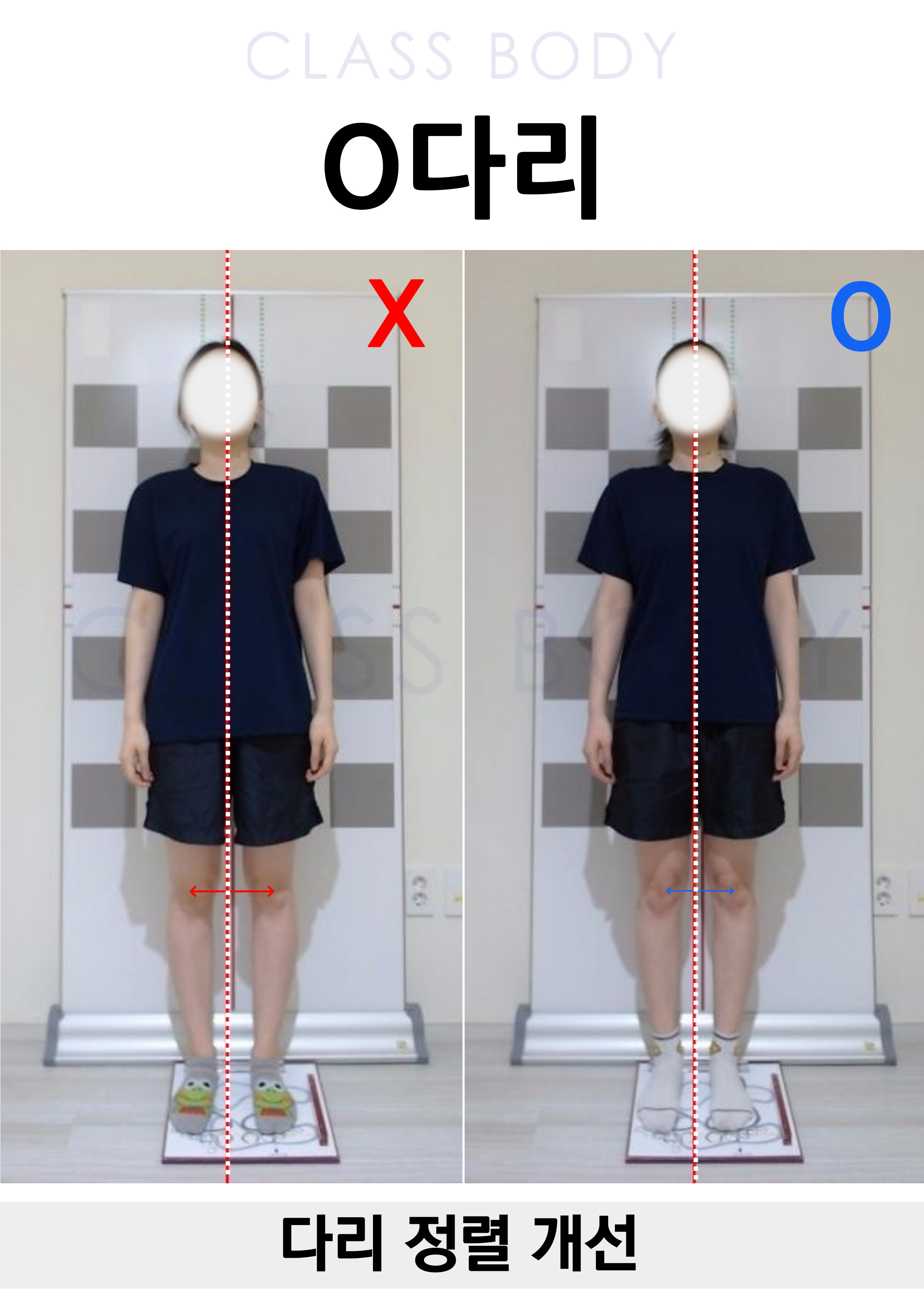 O다리개선