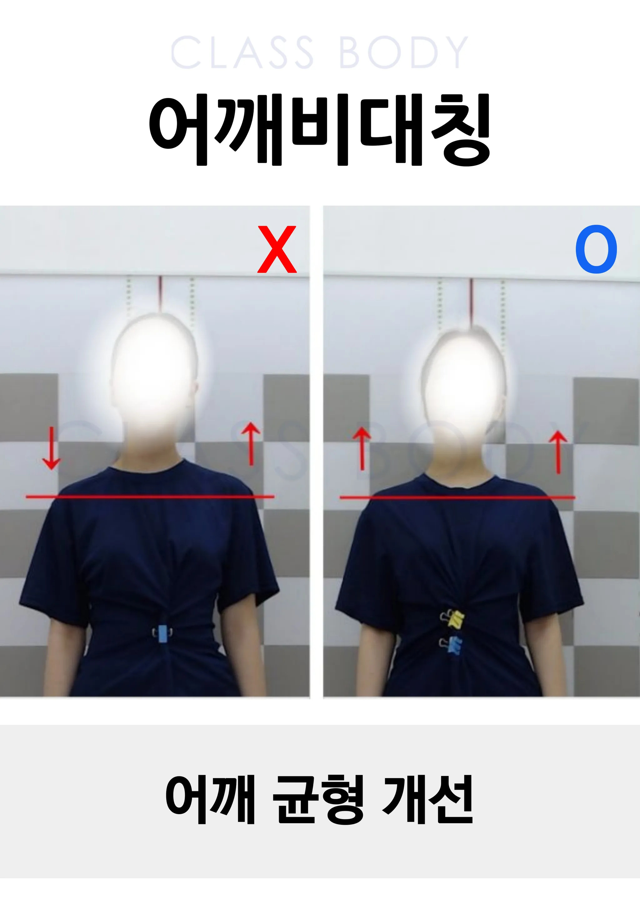 어깨 균형 개선
