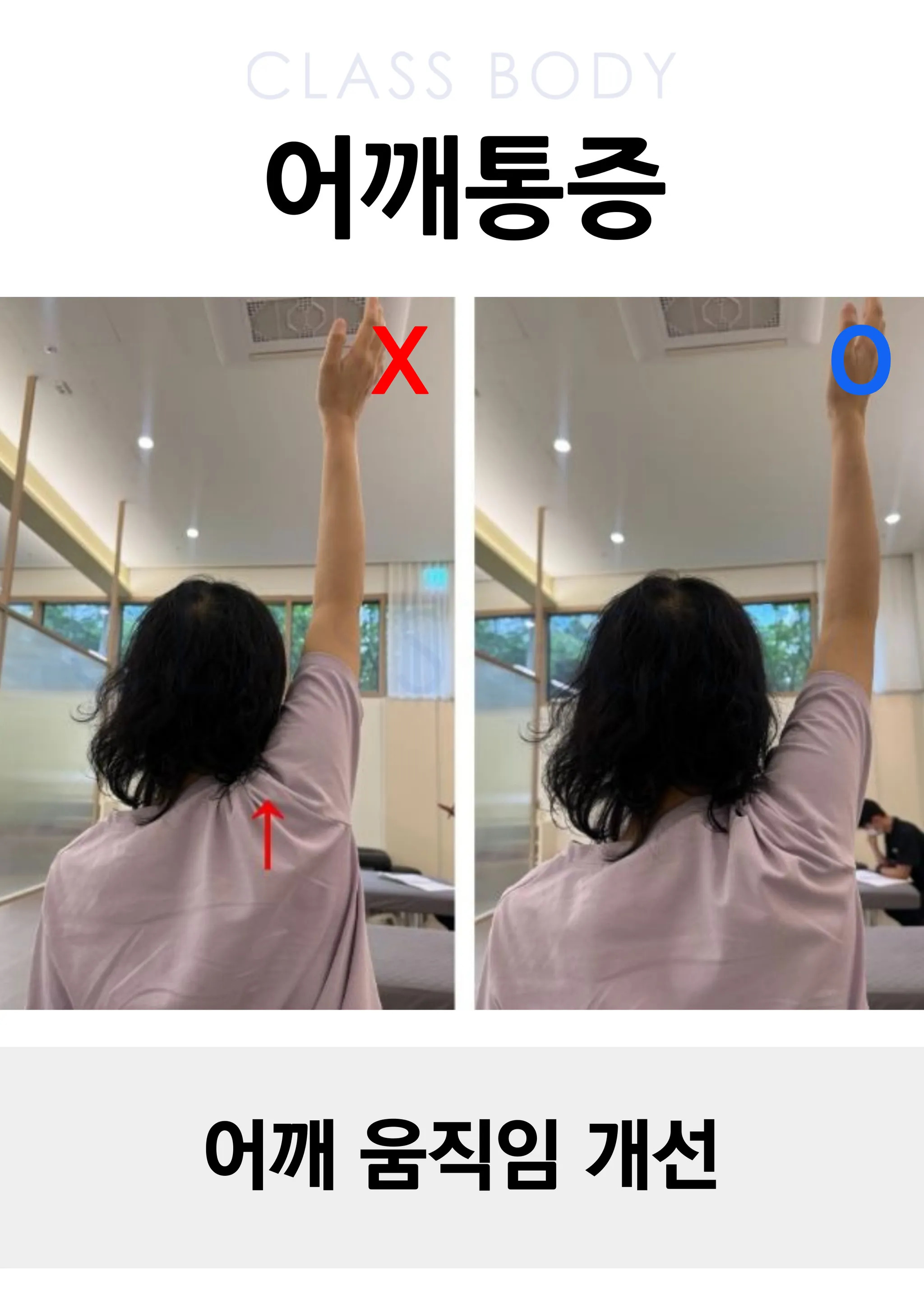 어깨 움직임 개선