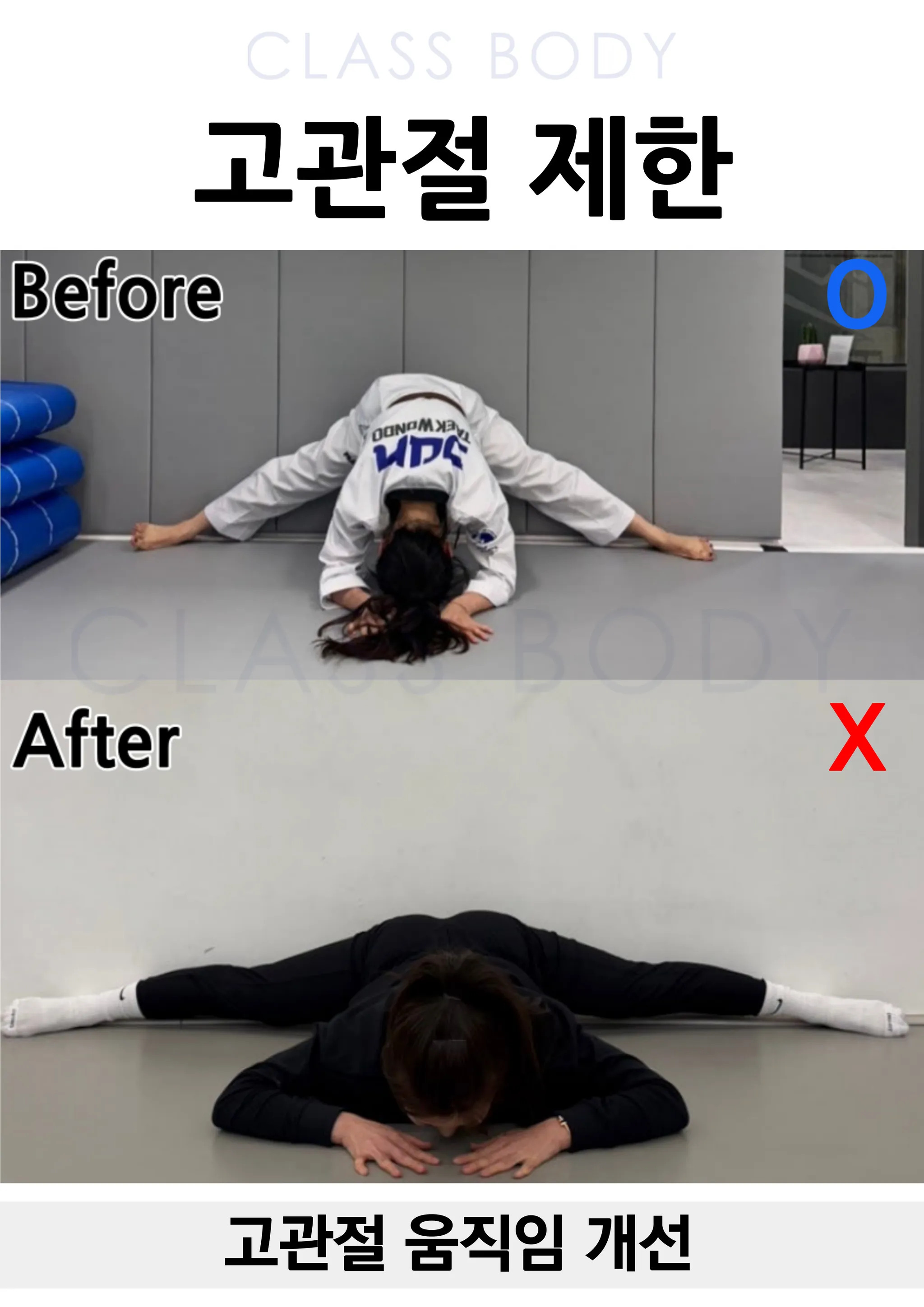 고관절 움직임 개선