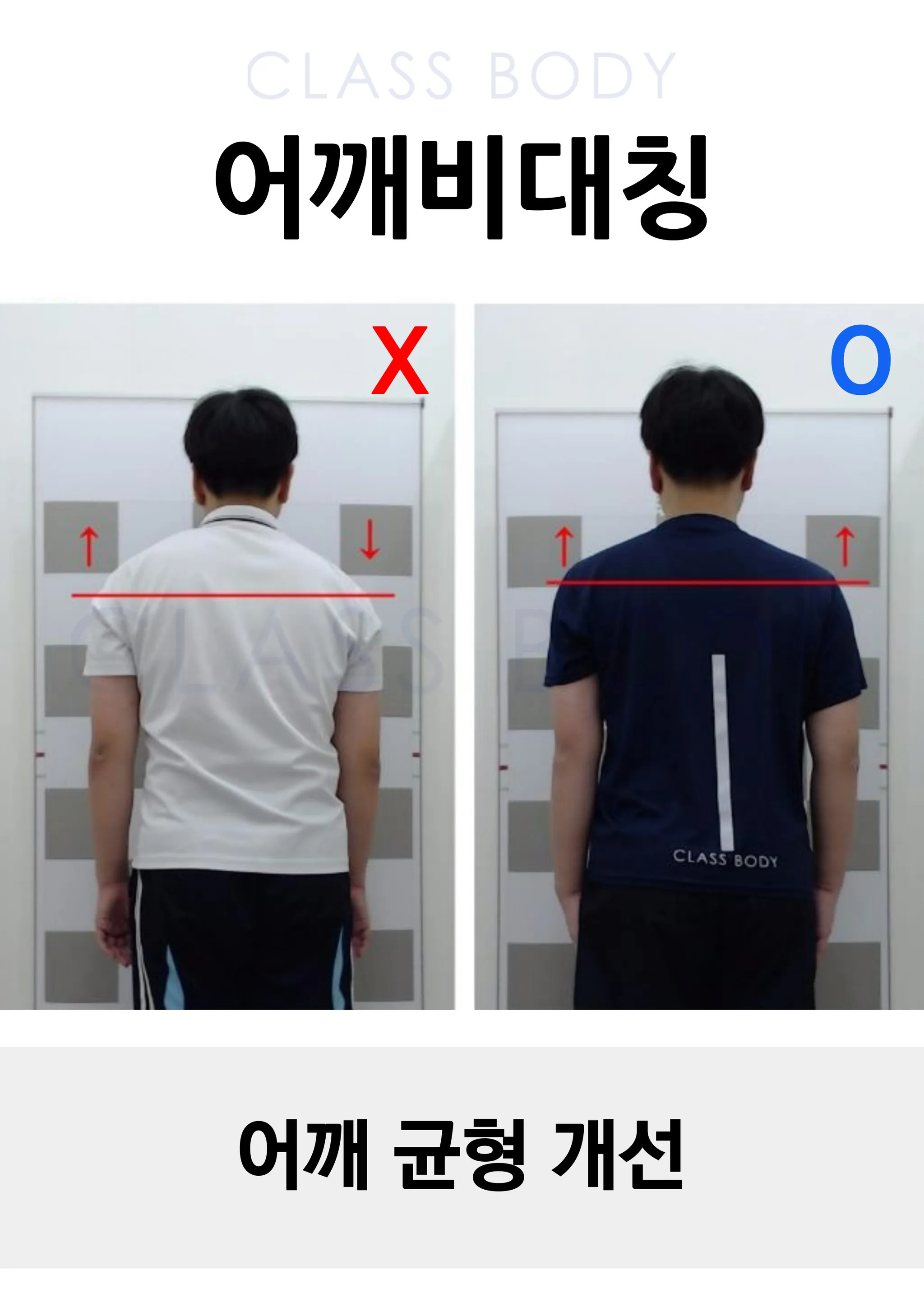 어깨 균형 개선