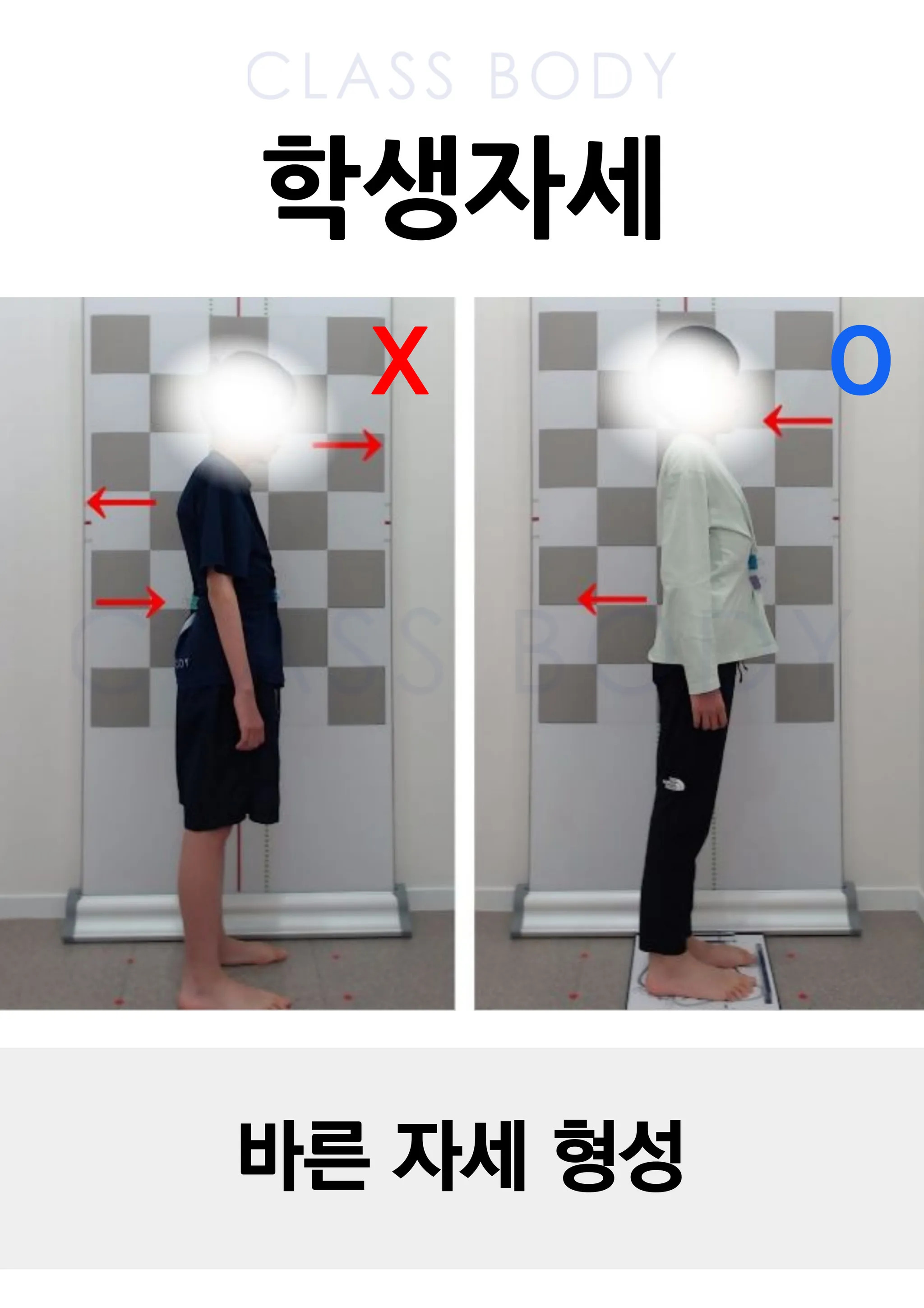 바른 자세 형성