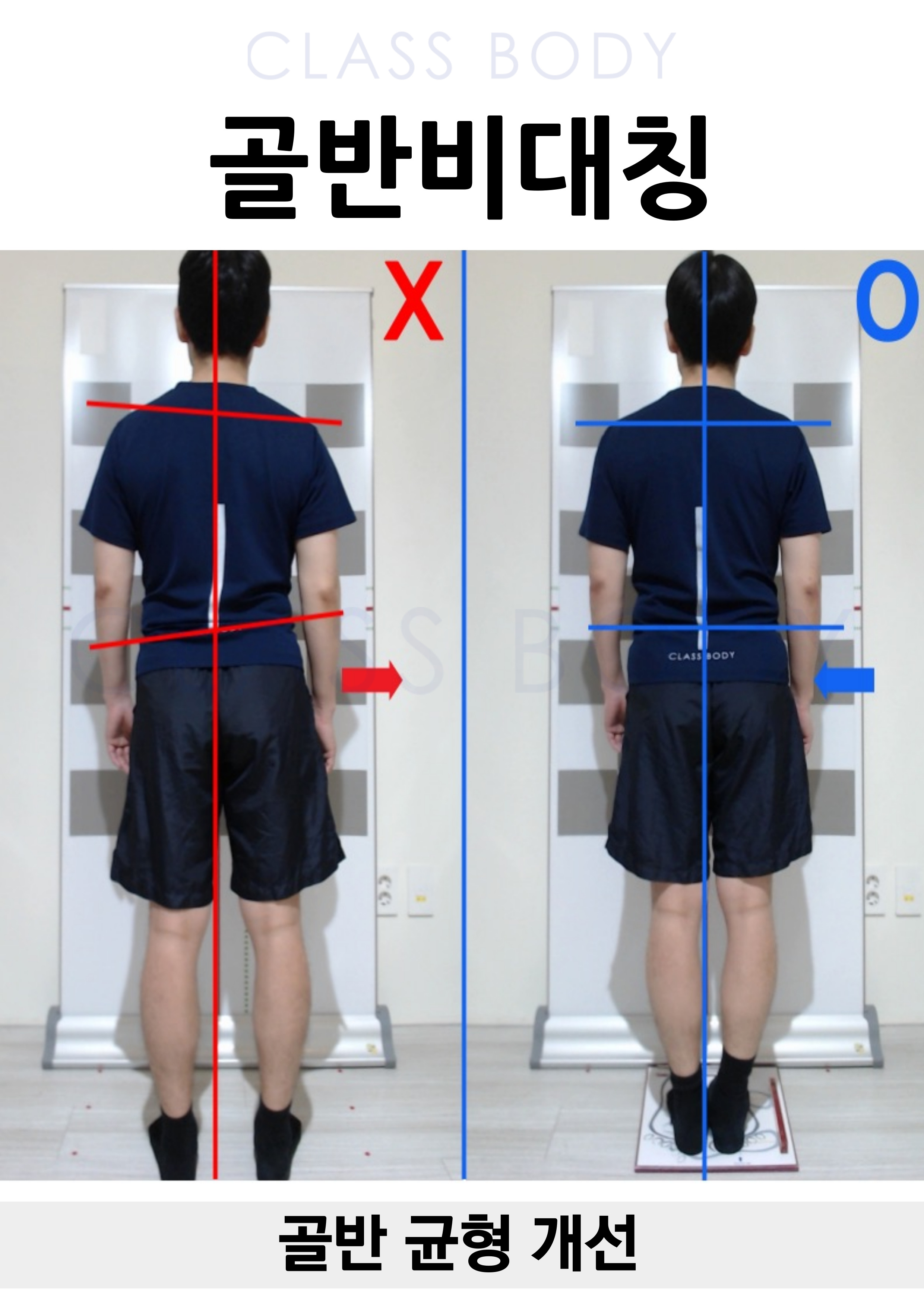 골반 균형 개선