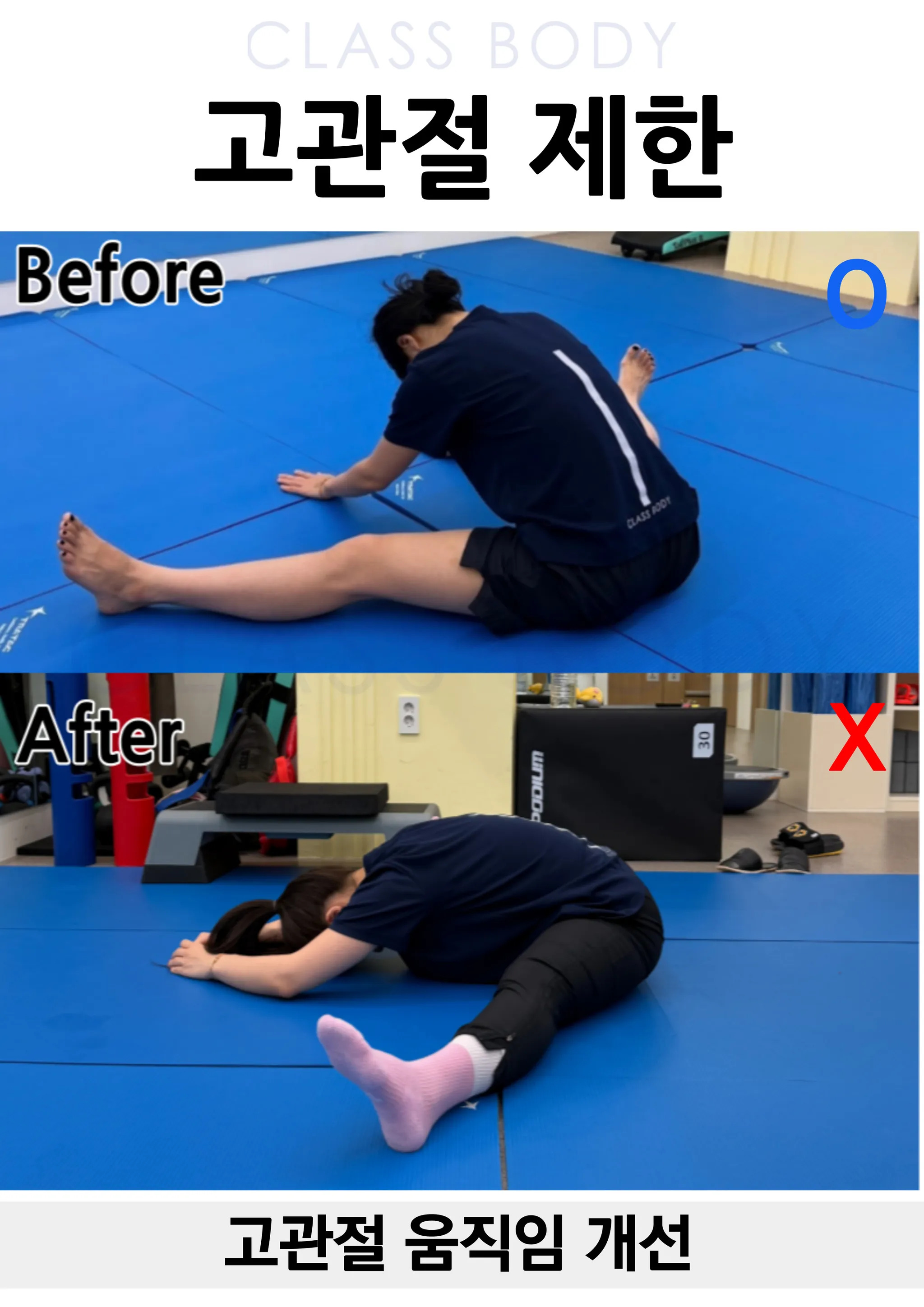 고관절 움직임 개선