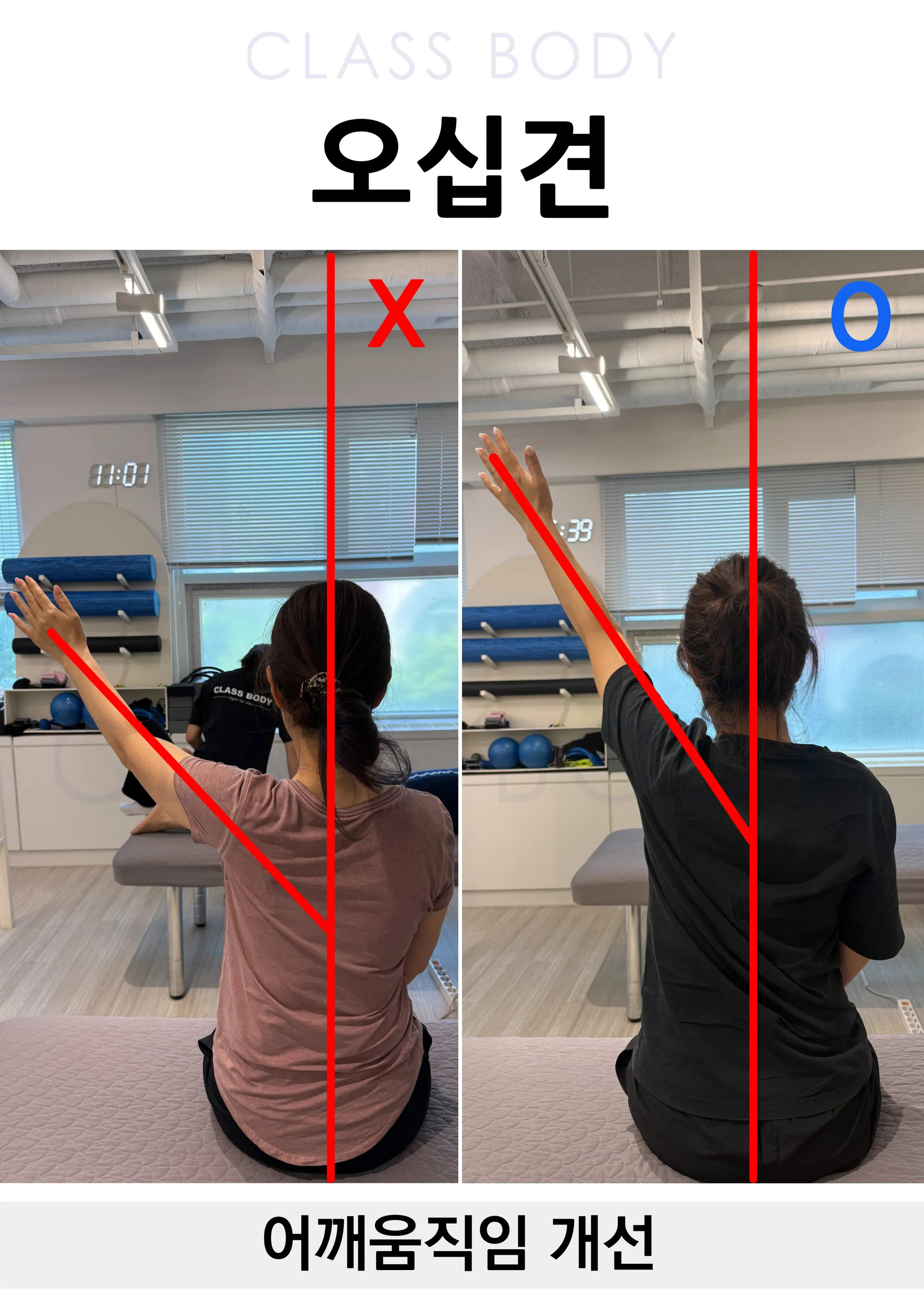 어깨 움직임 개선