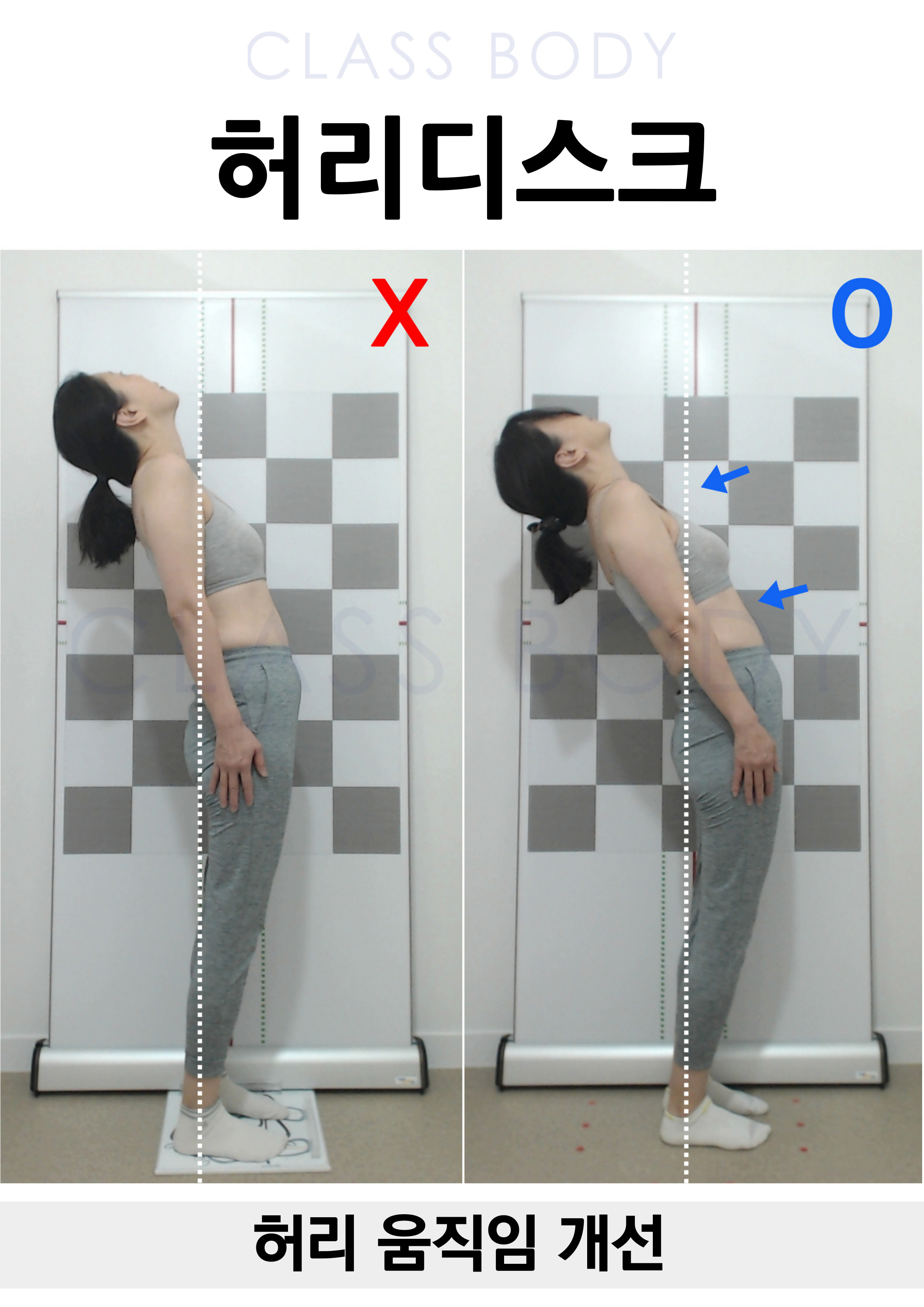 허리 움직임 개선