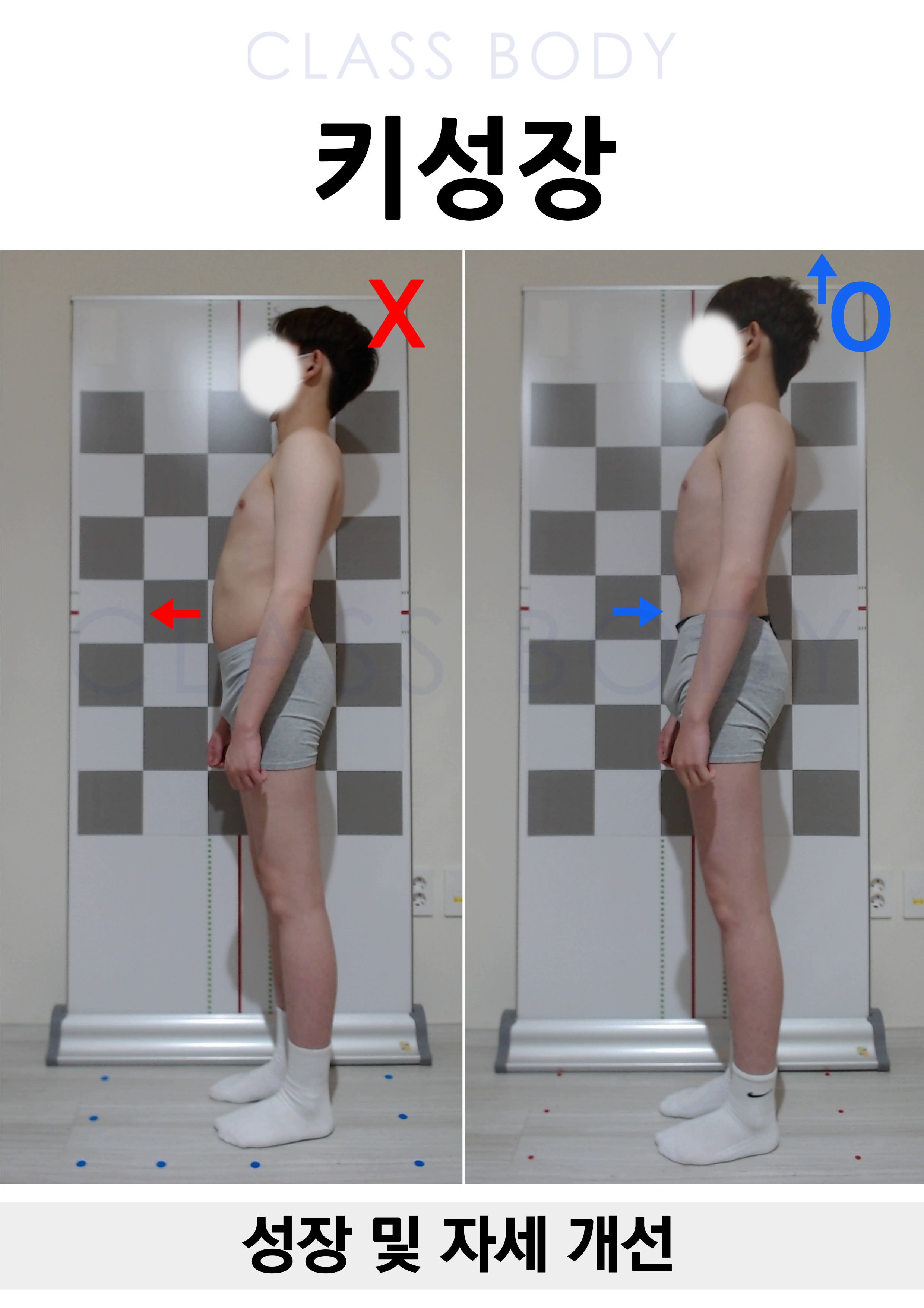 성장 및 자세 개선